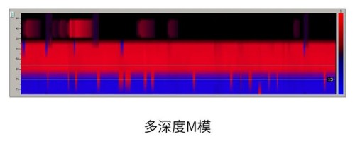 動態M模